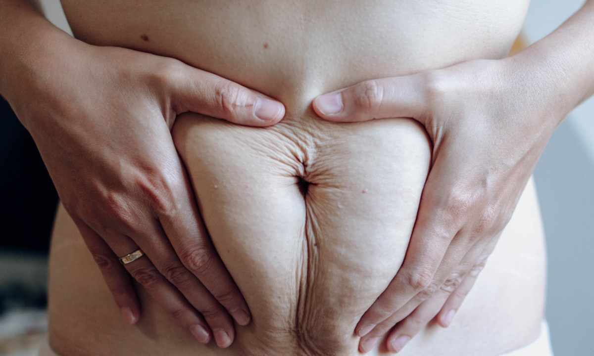 Woman holding a postpartum belly