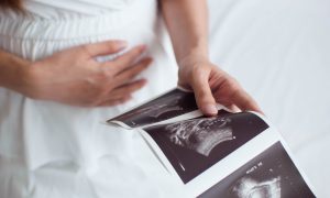 Pregnant woman at doctor's office looking at an ultrasound.