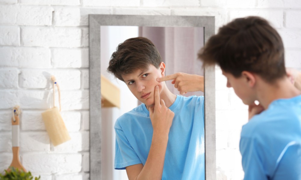 Boy trying to pop a pimple